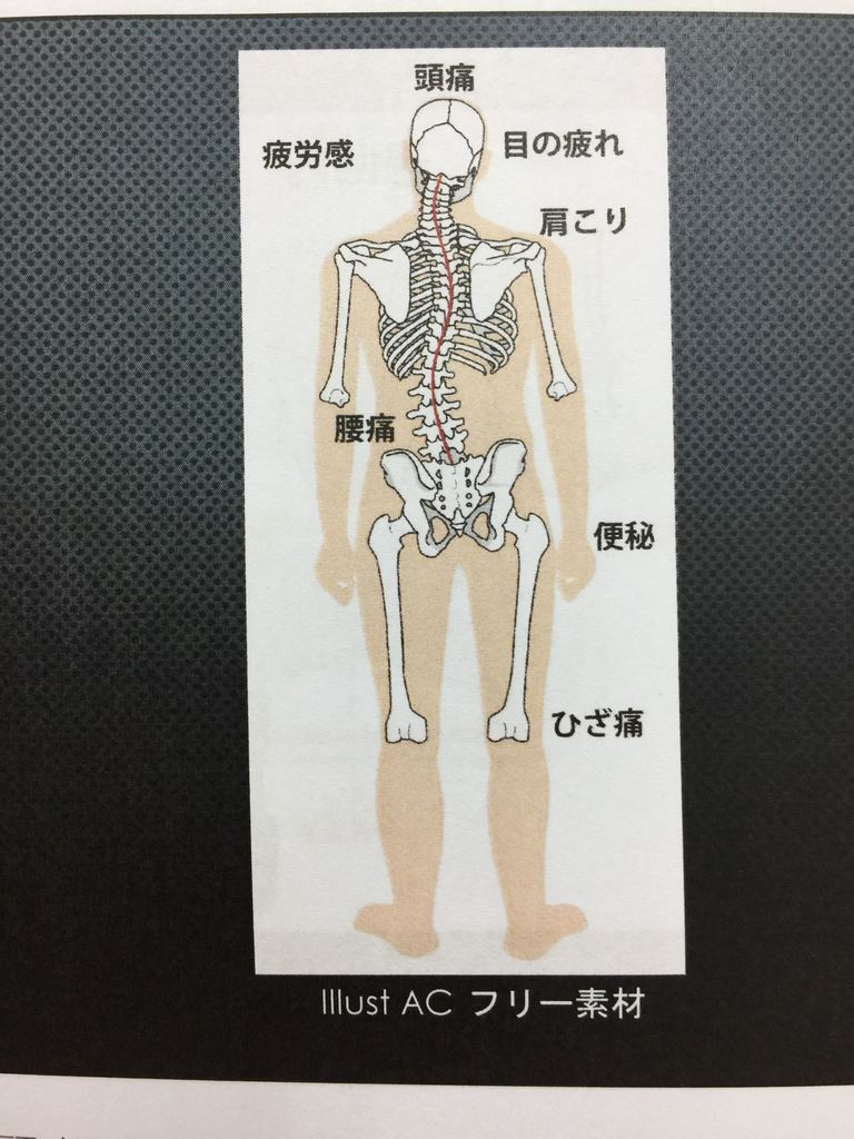 ストレッチをせずに柔軟性をあげるプログラムで使用した人体図